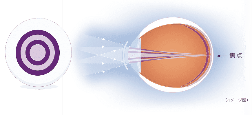 MiSight 1 day（マイサイト ワンデー）のページができていたのでまとめてみた